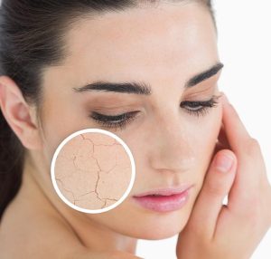 دلایل خشکی پوست