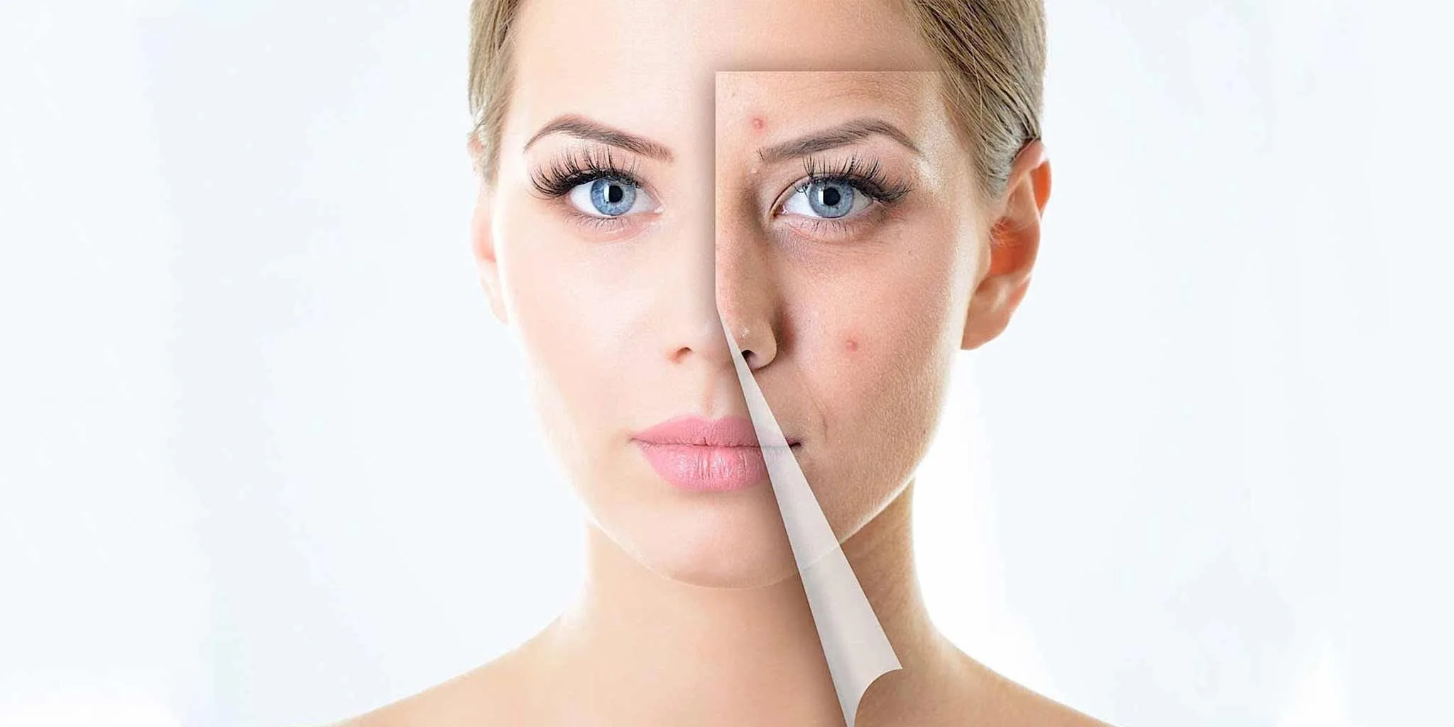 علت ایجاد جوش و راهکارهای درمانی آن