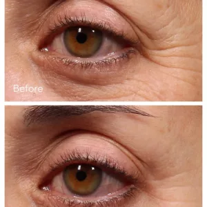 سرم دور چشم رتینول دکتر مورد Murad جوان ساز و ضد پیری فوق قوی (کد3827)