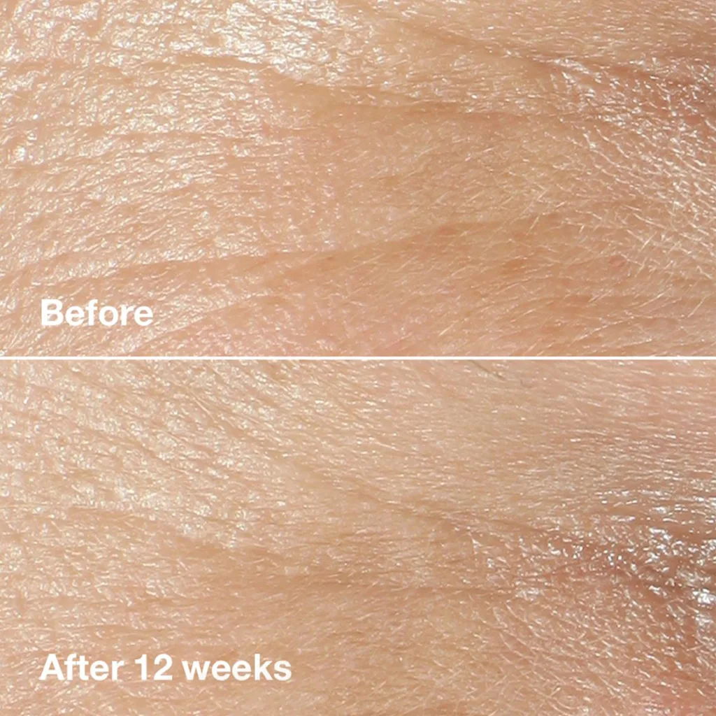 کرم دور چشم کلینیک ضد چروک ترمیم و آبرسانی و تغذیه کننده 15میل Clinique Smart Clinical Repair