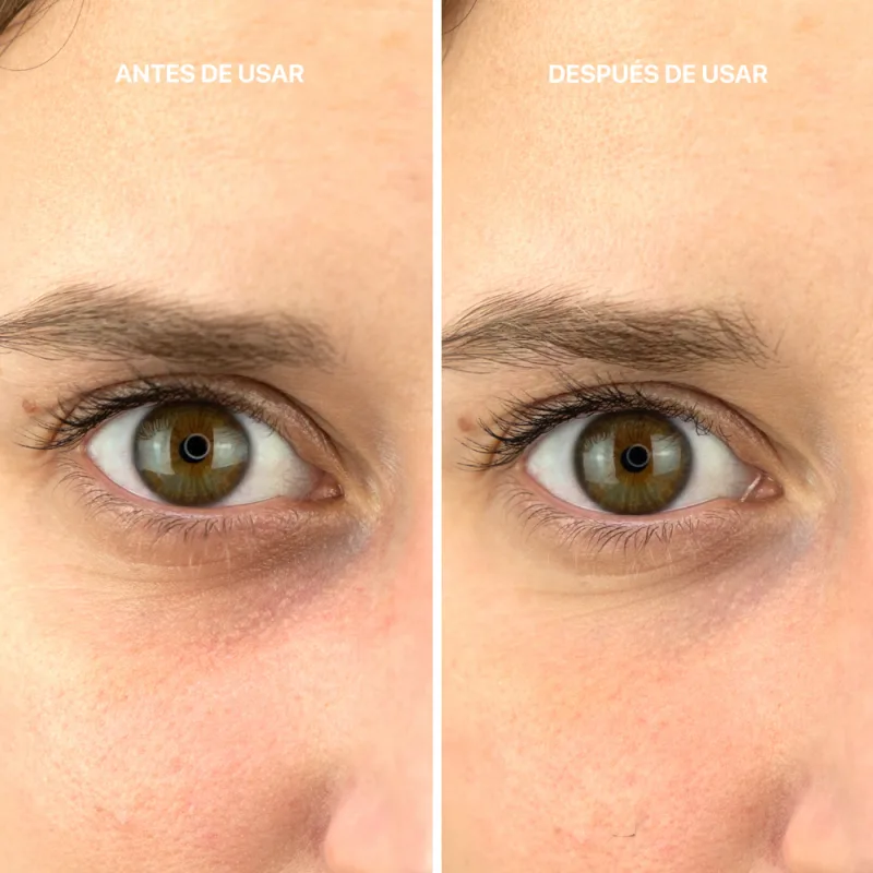 کرم دور چشم ژلی بوتولینوم لاکابین صاف کننده چروک عمیق با فیتوتنسور EYE GEL CREAM Botulinum effect کد6226