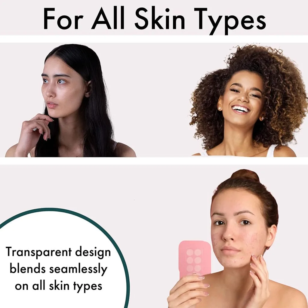 پچ-ضد-جوش-اورژانسی-نیچر-اسپل-درمان-فوری-انواع-جوش-min