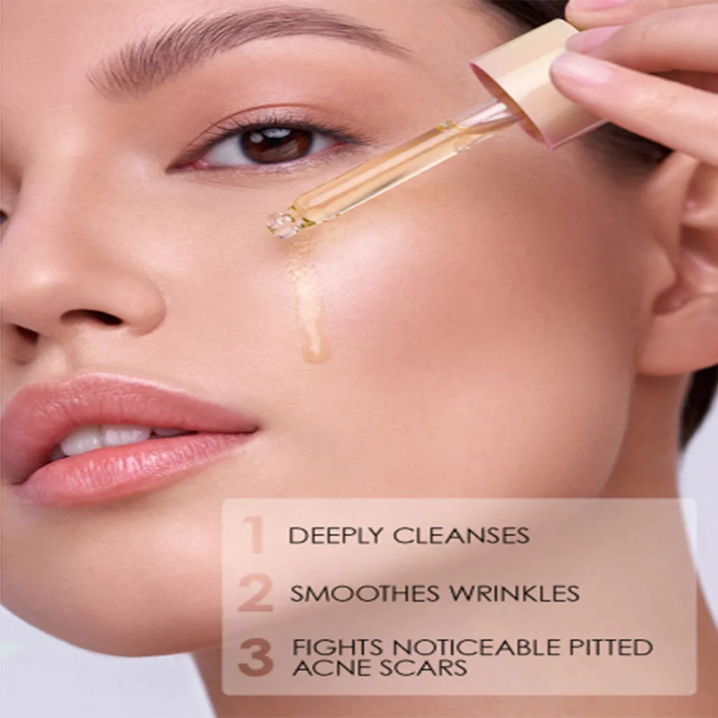 سرم لایه بردار پیلینگ سون دیز