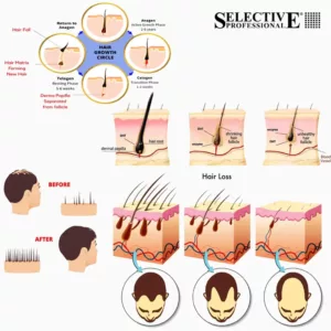 لوسیون ضد ریزش آقایان سلکتیو