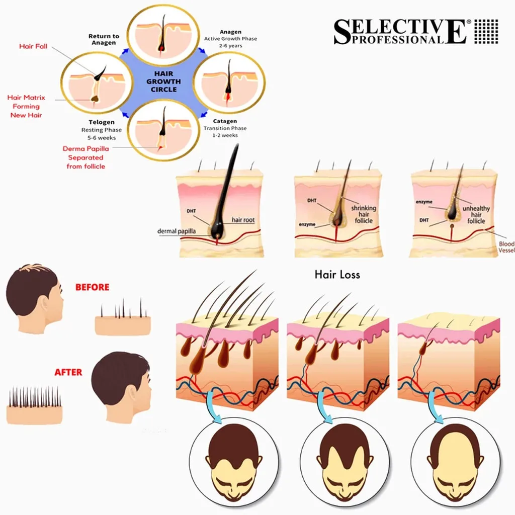 لوسیون ضد ریزش آقایان سلکتیو