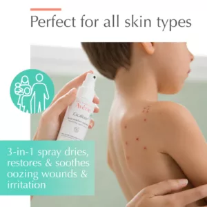 اسپری ترمیم زخم سیکالفیت اون