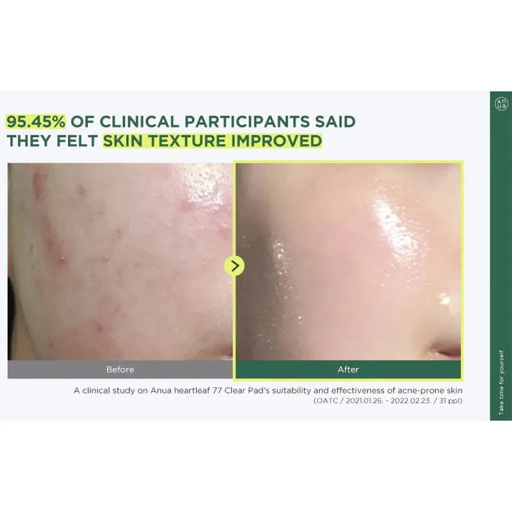 پد پاکسازی کننده و تسکین دهنده آنوا