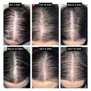 پک 3 تایی شامپو، ماسک مو و روغن ضد ریزش حاوی رزماری و بیوتین