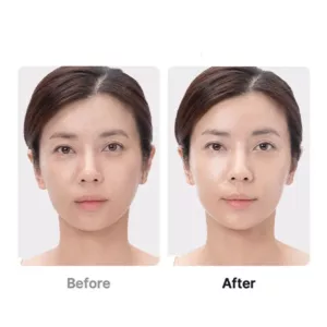 بوستر پرو مدیکیوب AGE-R Booster Pro