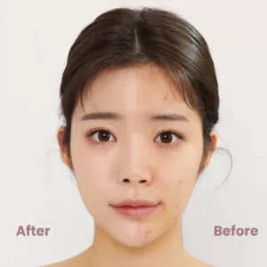 کوشن تیر تیر صورتی ضد چروک و روشن کننده