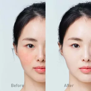 ضدآفتاب ضد قرمزی نامبوزین مدل Derma Tone Up