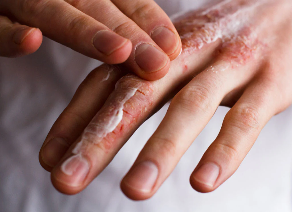 کرم دست چیه و به چه دردی میخوره؟