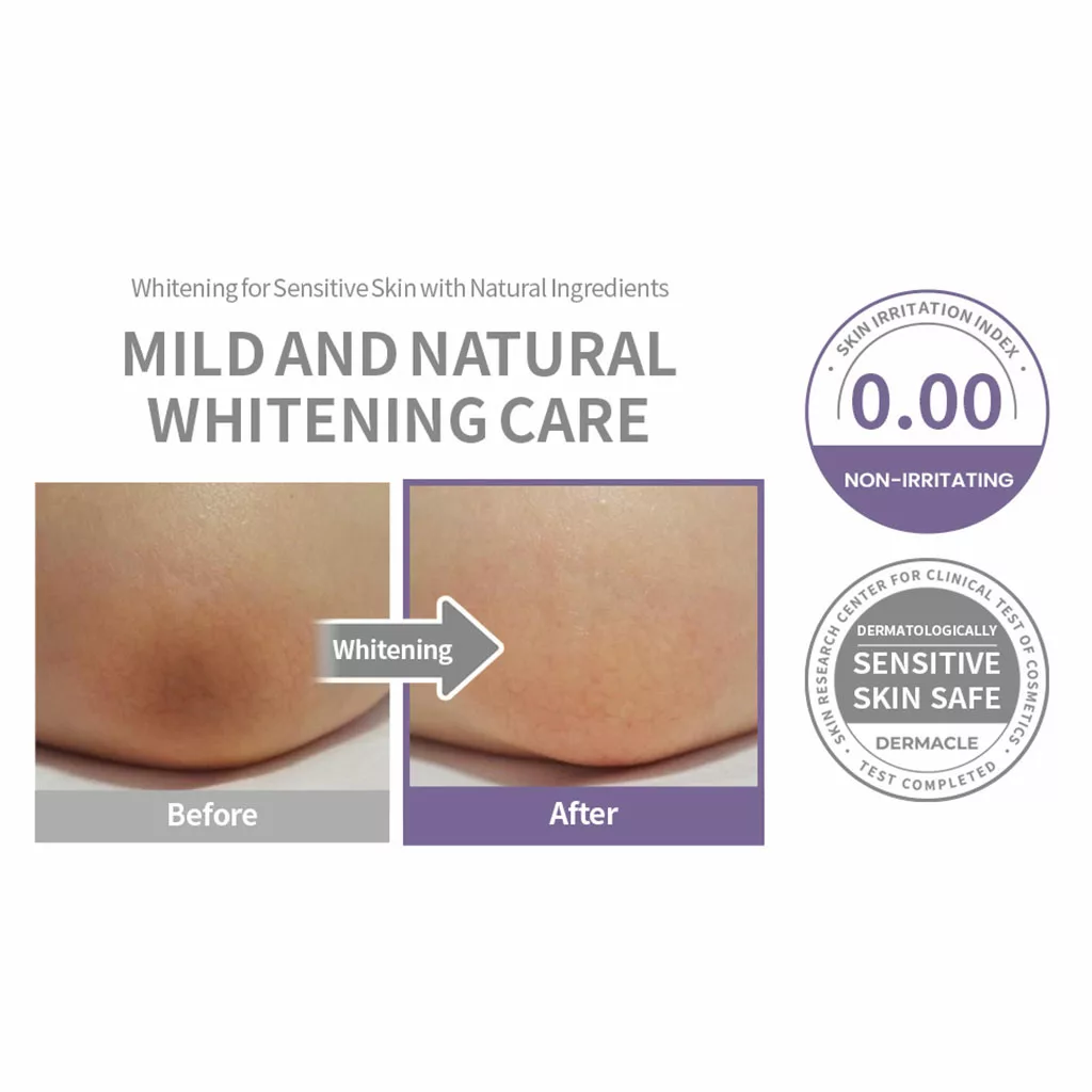 سفید کننده secret KEY مخصوص نواحی حساس بدن SNOW WHITE SPOT Gel