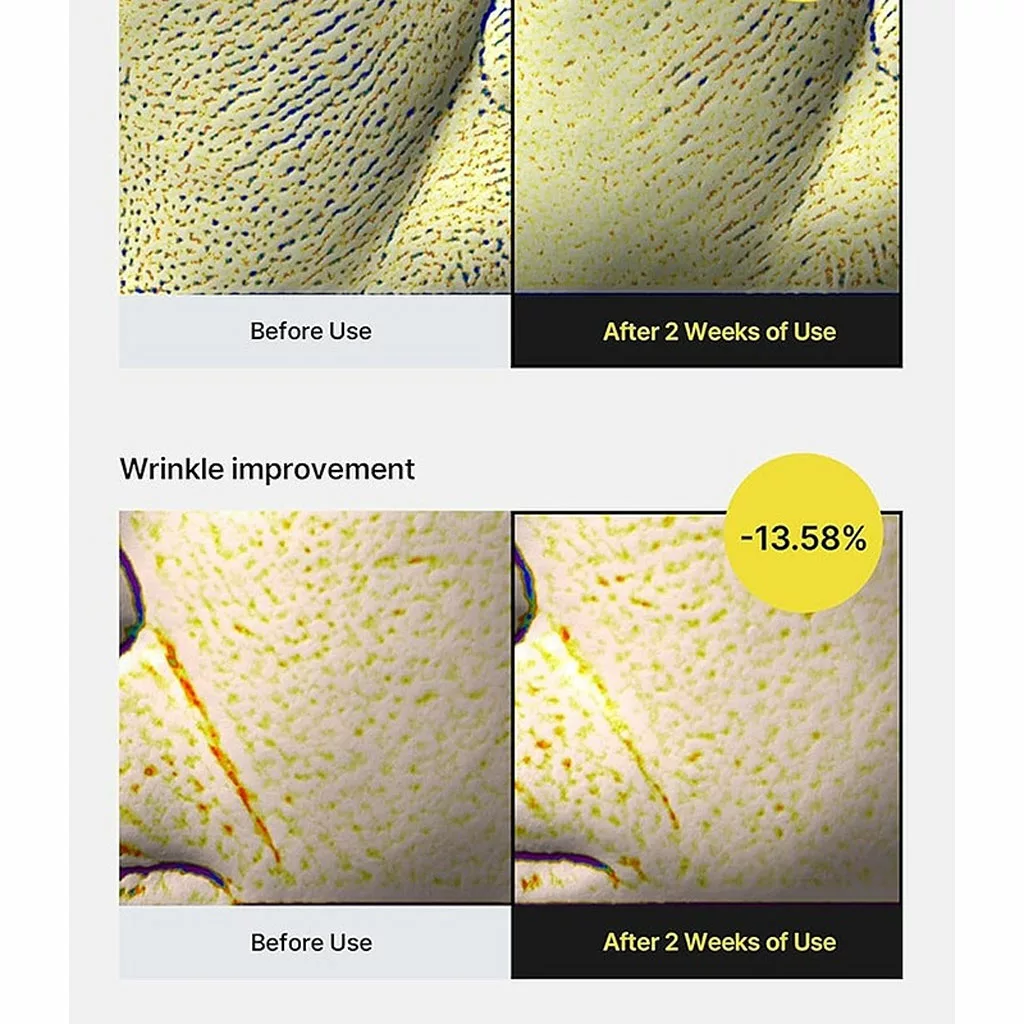 رتینول کلایمکس 0.1% (سلیمکس)