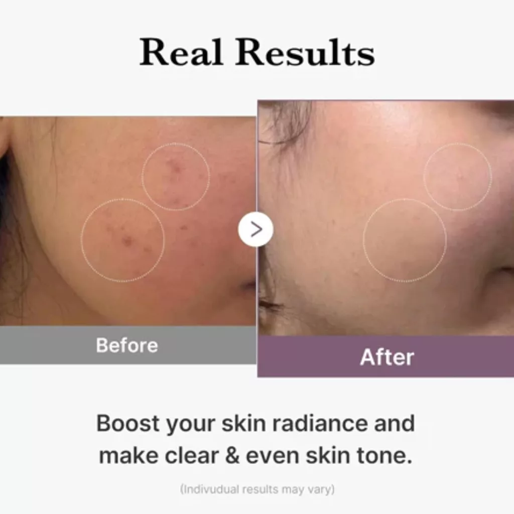 تونر گلوتاتیون مدی کیوب AGE-R