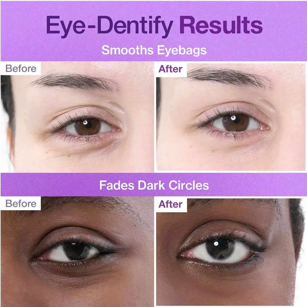 پچ زیر چشم نامبوزین +9