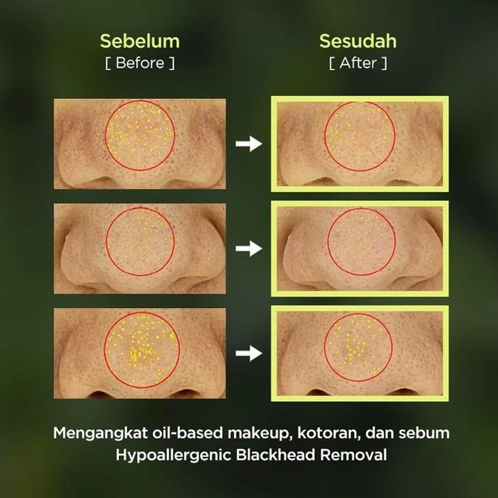 روغن پاک کننده کوزارکس سیکا CICA CLEANING OIL