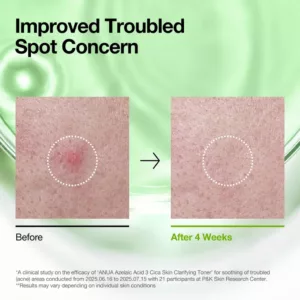 تونر آزلائیک اسید CICA آنوا +3