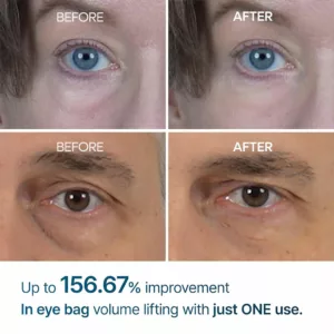 کرم دور چشم دکتر ملاکسین ضد چروک روشن کننده