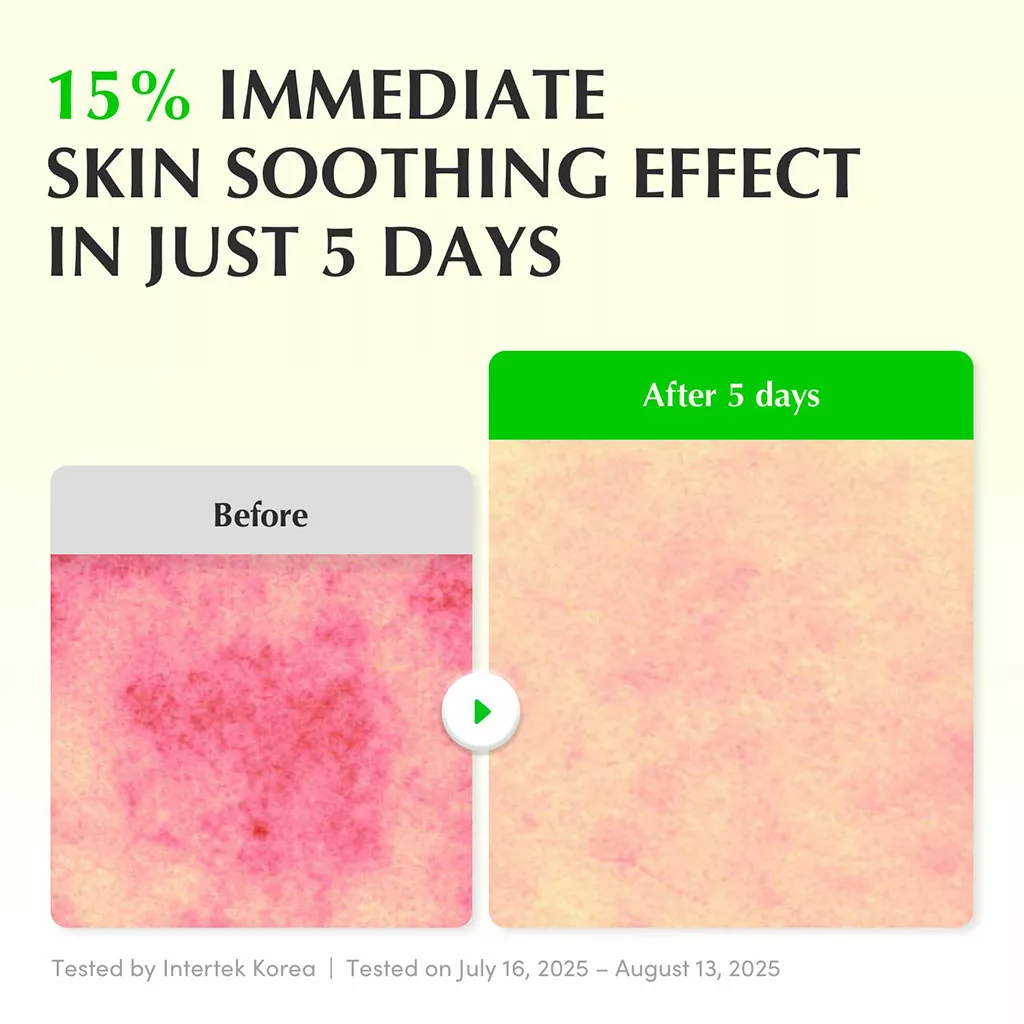 سرم تسکین دهنده Aloe PDRN اکوال بری