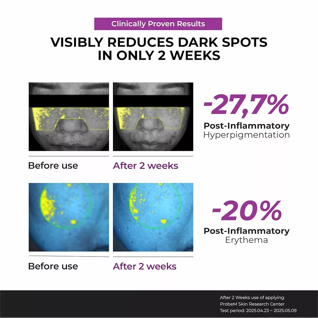 ضرم ضد لک نیاسینامید جومیسو Dark Spot Correcting