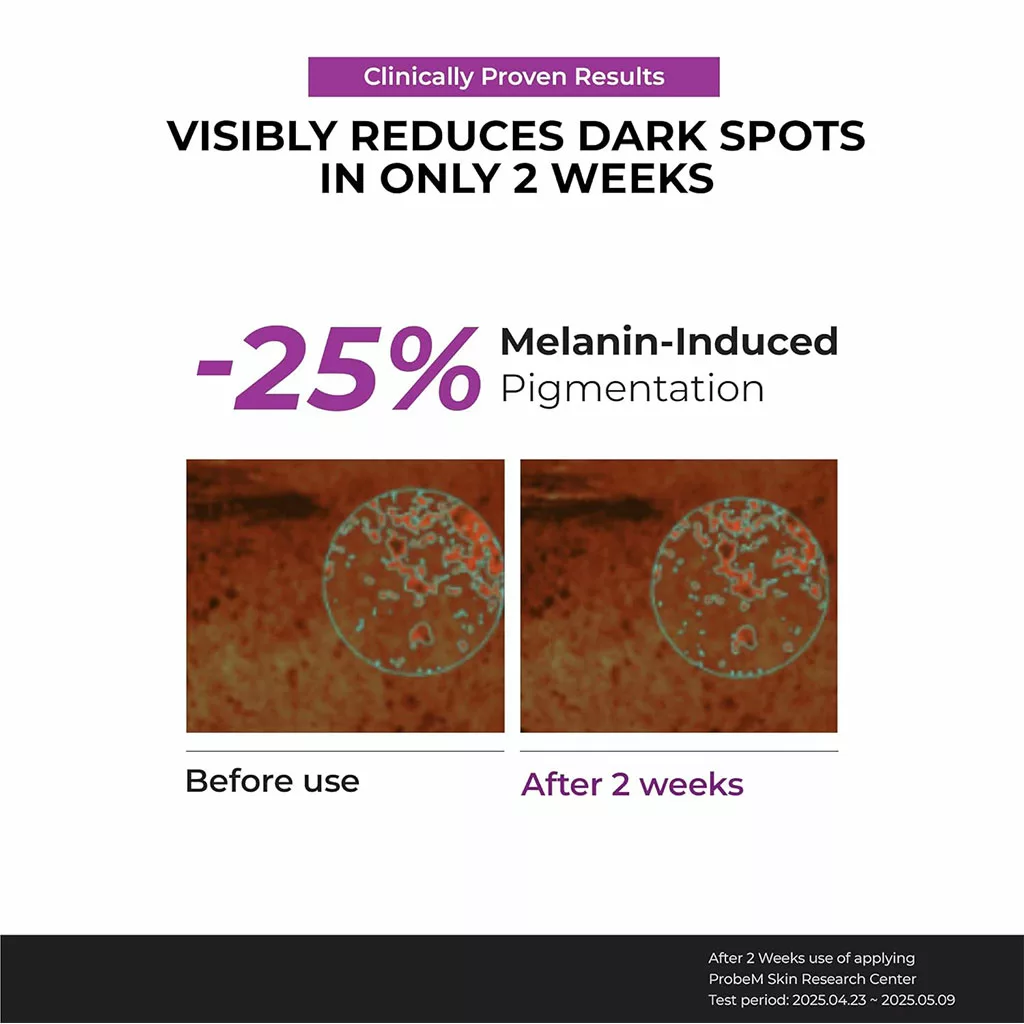 ضرم ضد لک نیاسینامید جومیسو Dark Spot Correcting