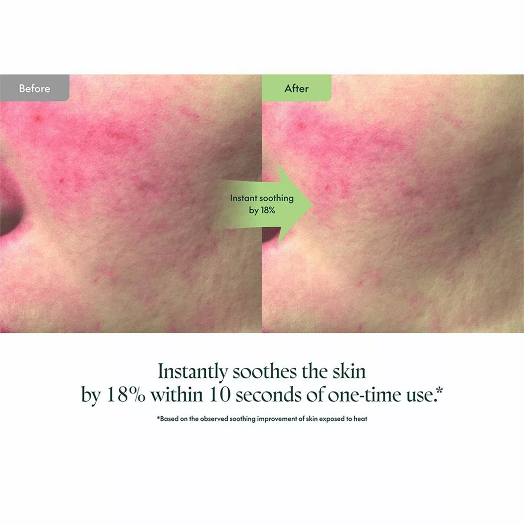 سرم پیوریتو وندر تسکین دهنده حاوی سنتلا Purito