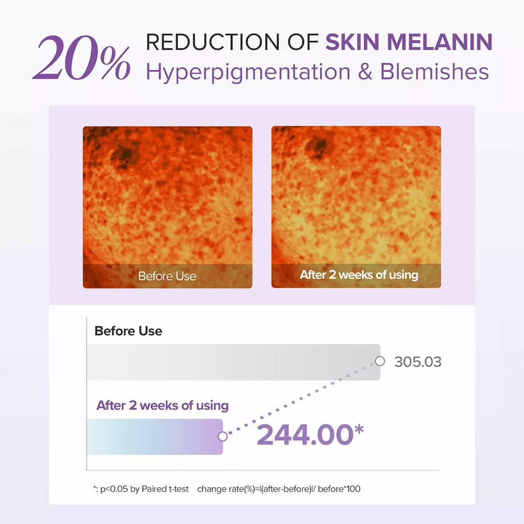 دور چشم ماری اند می ضد لک روشن کننده Tranexamic+glutathione