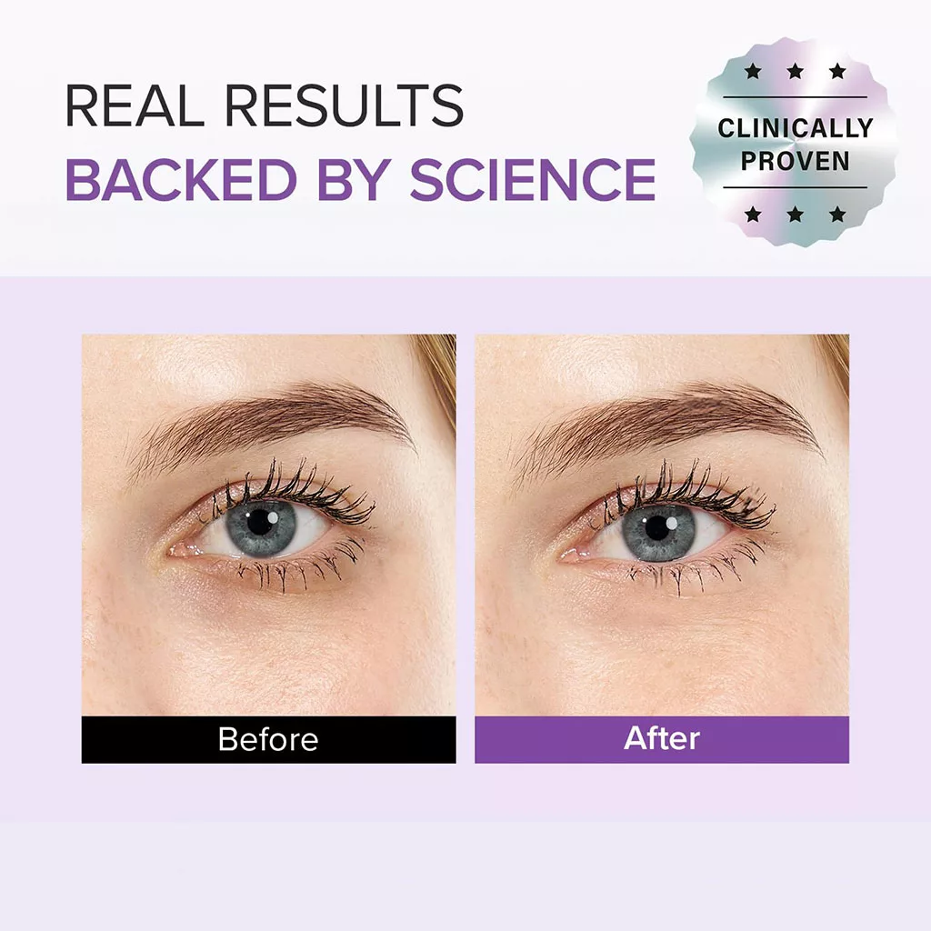 دور چشم ماری اند می ضد لک روشن کننده Tranexamic+glutathione