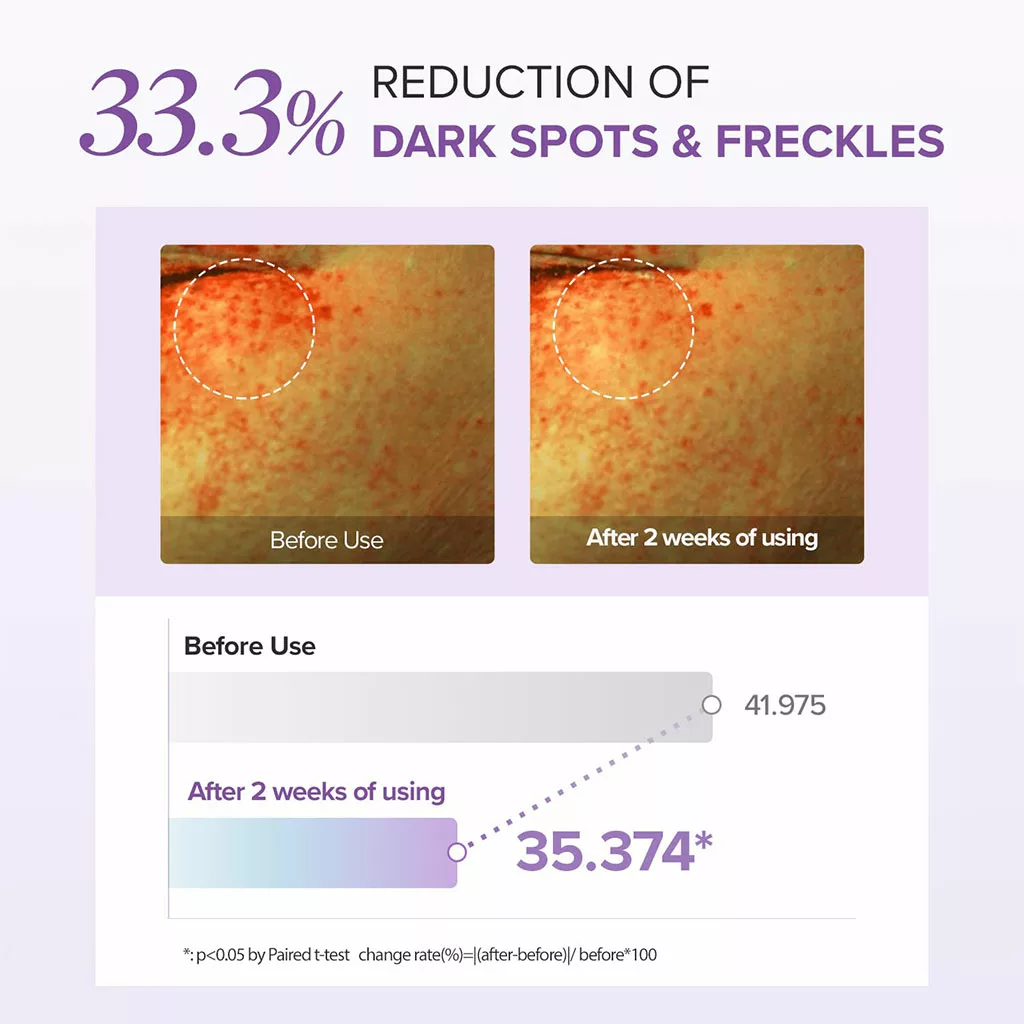 دور چشم ماری اند می ضد لک روشن کننده Tranexamic+glutathione