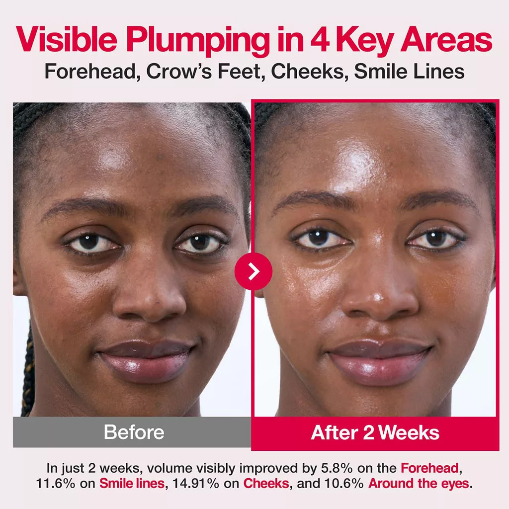 سرم کلاژن 2X نامبوزین PDRN ROSE پلامپینگ shot collagen