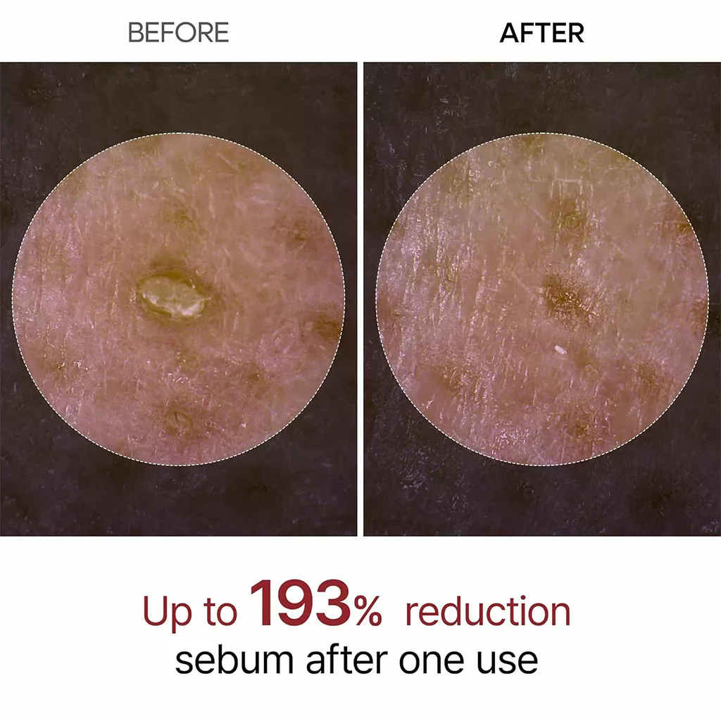 آمپول پیل شات دکتر ملاکسین لایه بردار روشن کننده پوست