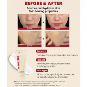 کرم اسنس حلزون 93% سئول 1988 کی سکرت K-SECRET