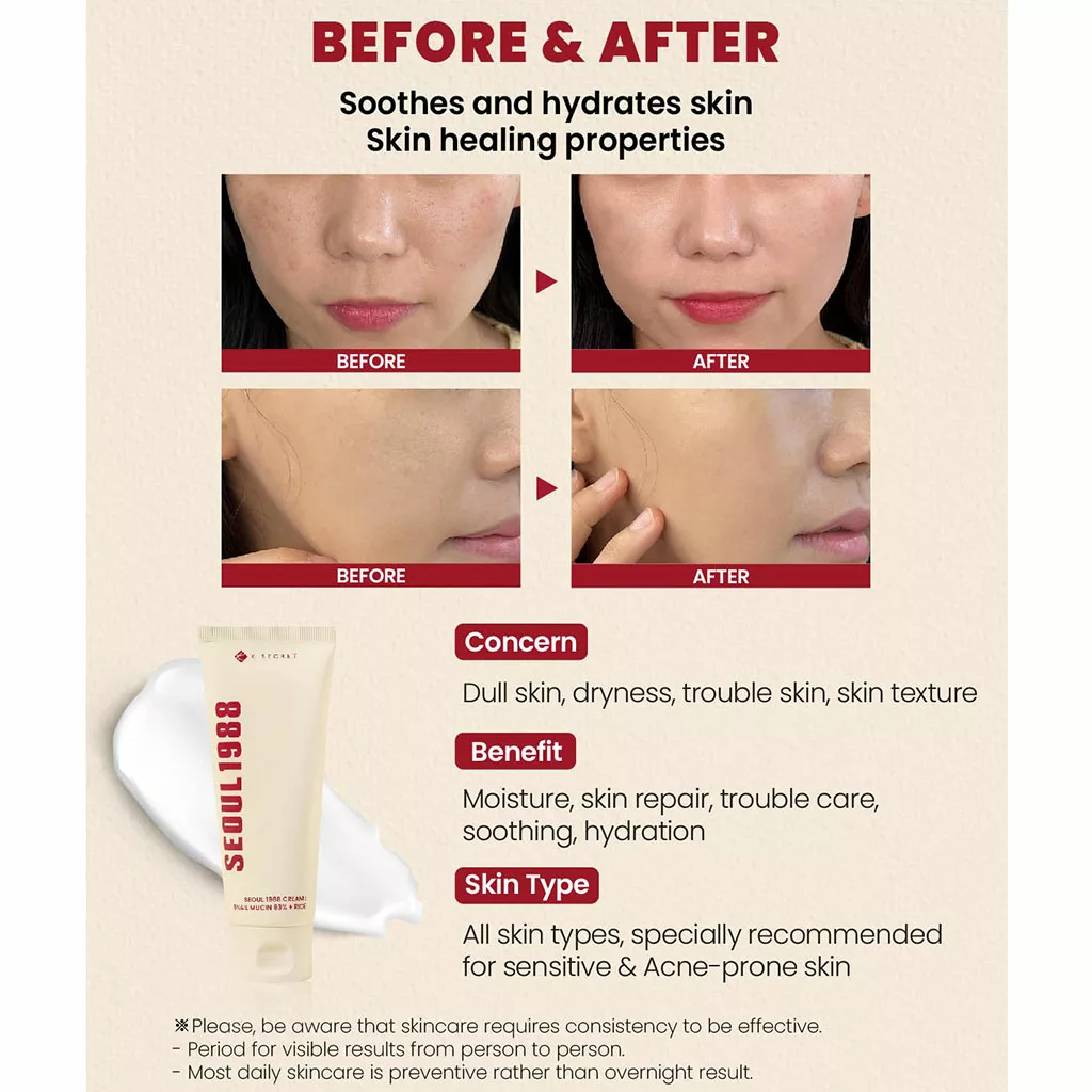 کرم اسنس حلزون 93% سئول 1988 کی سکرت K-SECRET