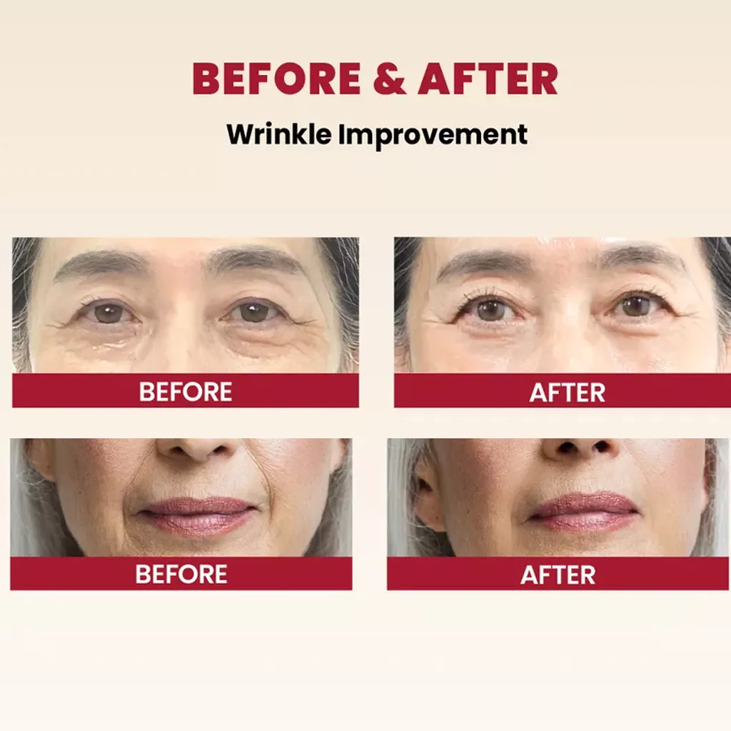 کرم رتینال لیپوزوم 1% سئول 1988 K-SECRET