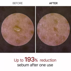 آمپول پیل شات دکتر ملاکسین برنج سیاه لایه بردار روشن کننده پوست