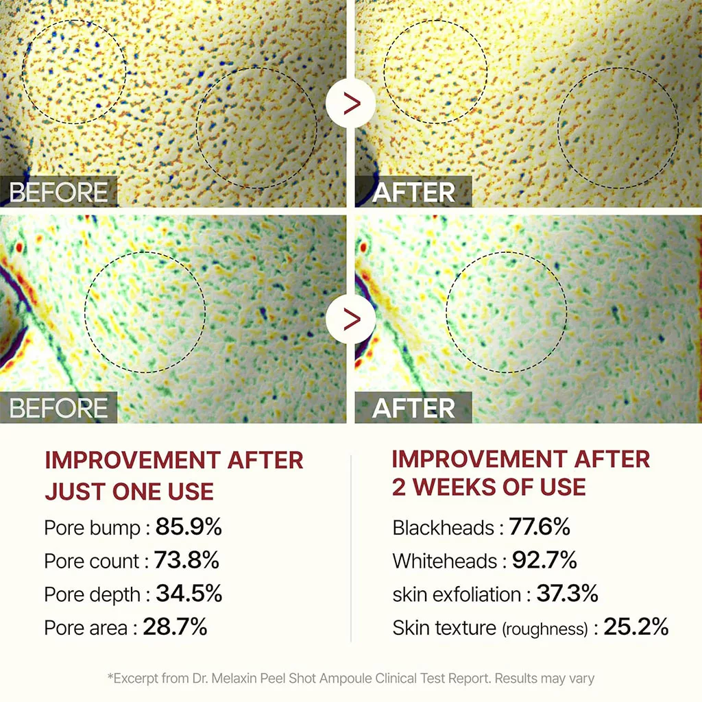 آمپول پیل شات دکتر ملاکسین برنج سیاه لایه بردار روشن کننده پوست