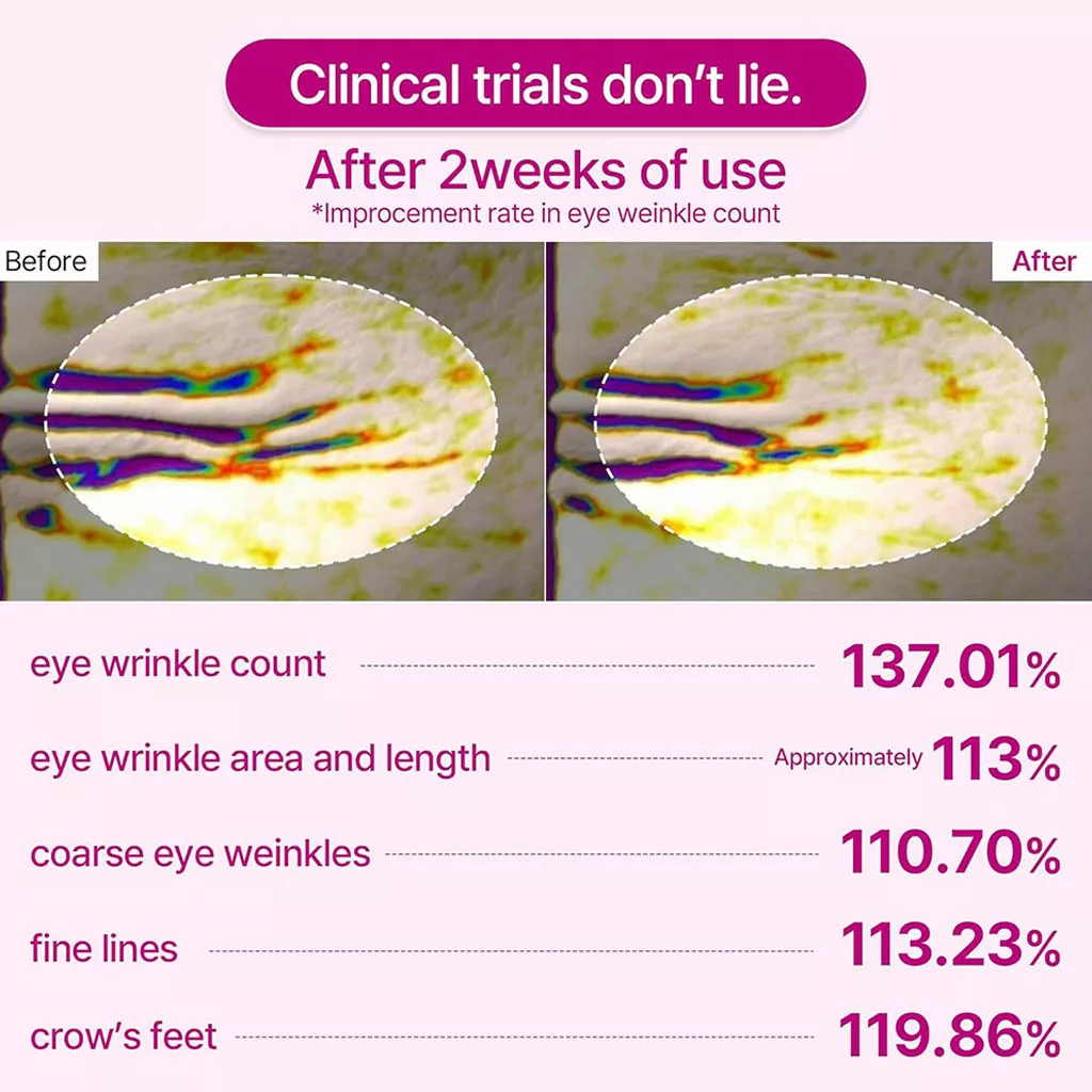 پچ دور چشم ضد چروک و روشن کننده دکتر ملاکسین