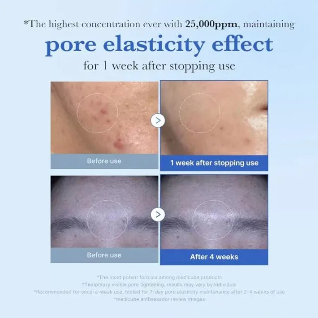 سرم اگزوزوم ضد منافذ و لایه بردار