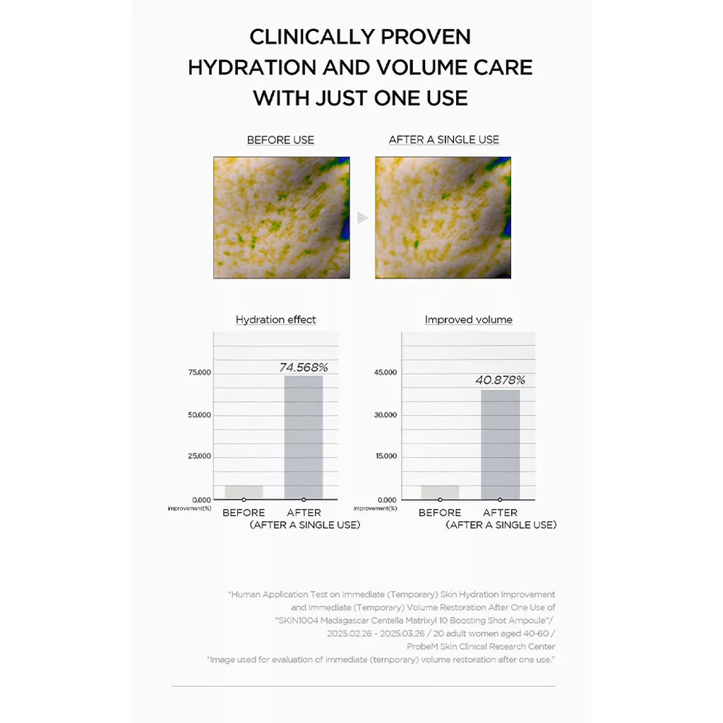 آمپول آبرسان و ضد چروک ماتریکسل
