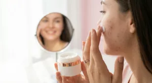 راهنمای انتخاب بهترین کرم برای جای جوش و لک صورت