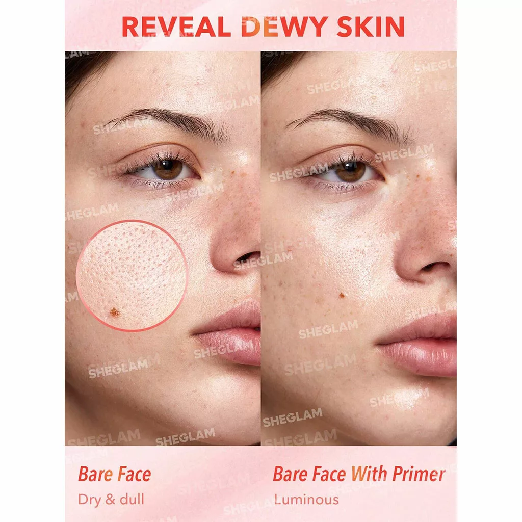 سرم پرایمر شیگلم حاوی نیاسینامید