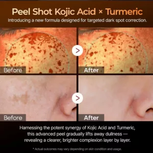 سرم لایه بردار و پاکسازی کننده کوجیک اسید و نیاسینامید دکتر ملاکسین