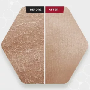 سرم پیلینگ لايه بردار زامبی بیوتی Aha peel