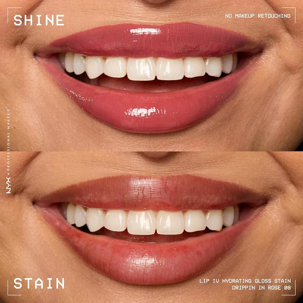 سرم لیپ گلاس آبرسان نیکس مدل lip iv