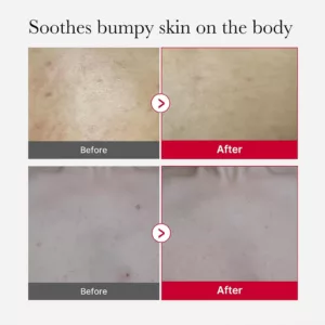 اسپری لایه بردار ضد جوش بدن مدی کیوب پیل شات RED ACNE BODY PEEL SHOT