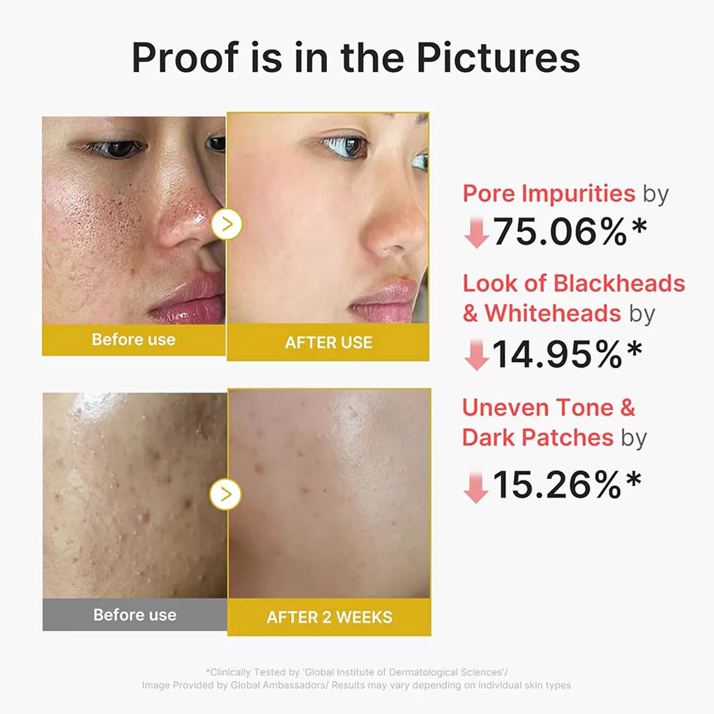 سرم لایه بردار ملایم مدی کیوب کوجیک اسید زردچوبه KOJIC ACID TURMERIC PEEL SHOT