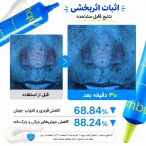 کرم ضد جوش فوری نامبوزین حاوی آزلاییک و نیاسینامید اسید