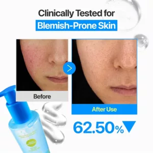 ژل میسلار بدون چربی نامبوزین Numbuzin oil free Micellar ZERO BLEMISH