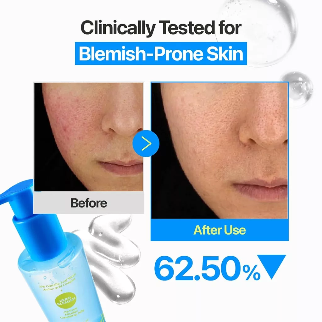 ژل میسلار بدون چربی نامبوزین Numbuzin oil free Micellar ZERO BLEMISH